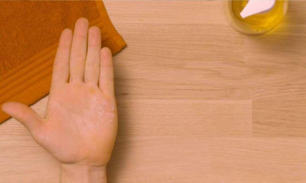 UK How to remove super glue from skin teaser